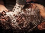 去植发前有哪些问题需要注意?